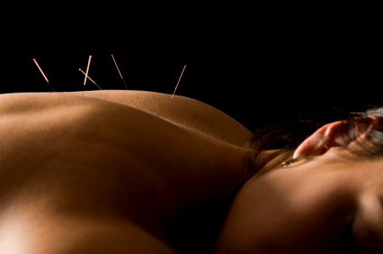 Acupuncture Needles on Back